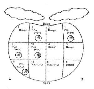GORDON - Biopsy Diagram - 1