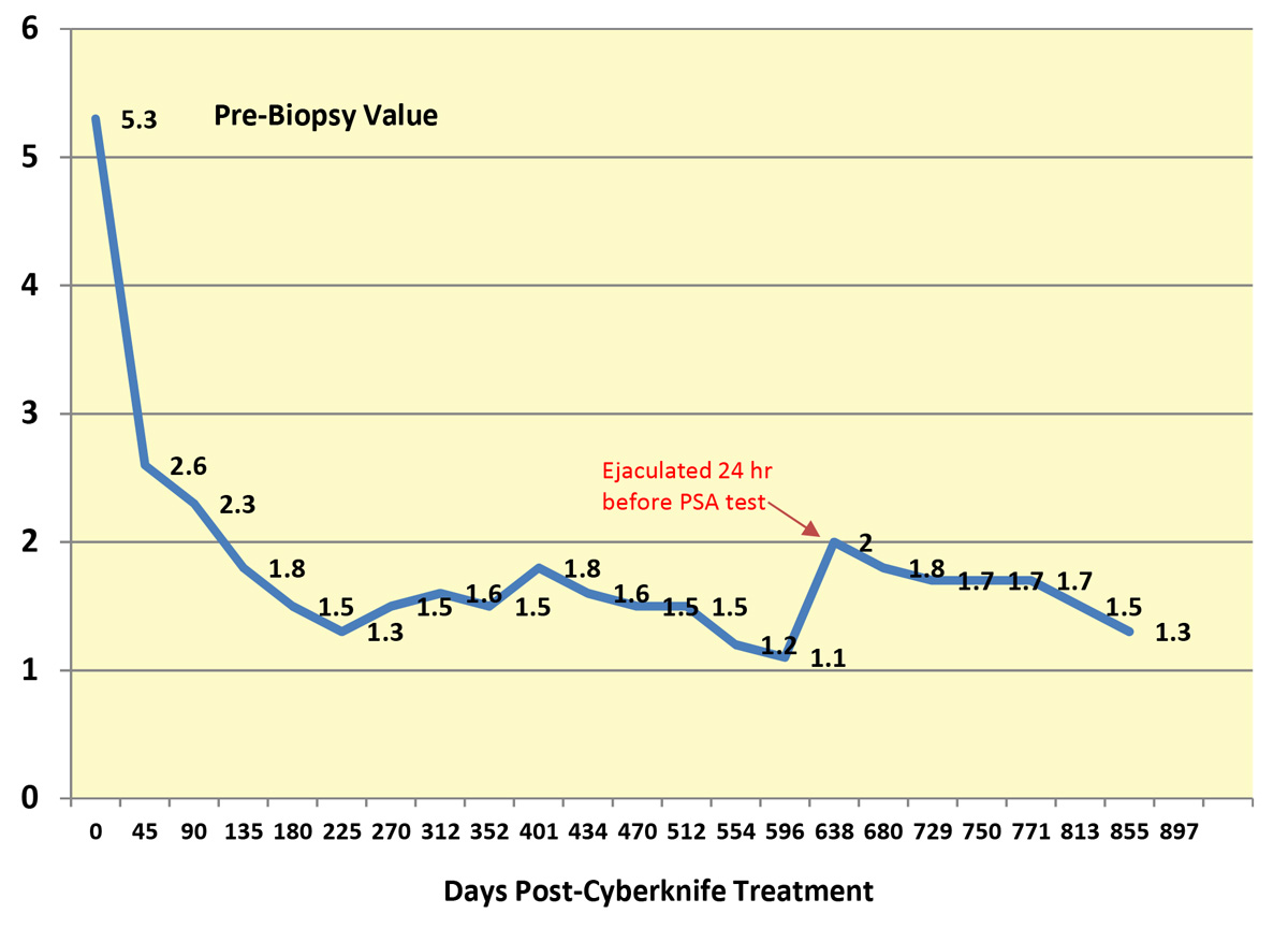 PSA Values - Blog Posting 855 Days