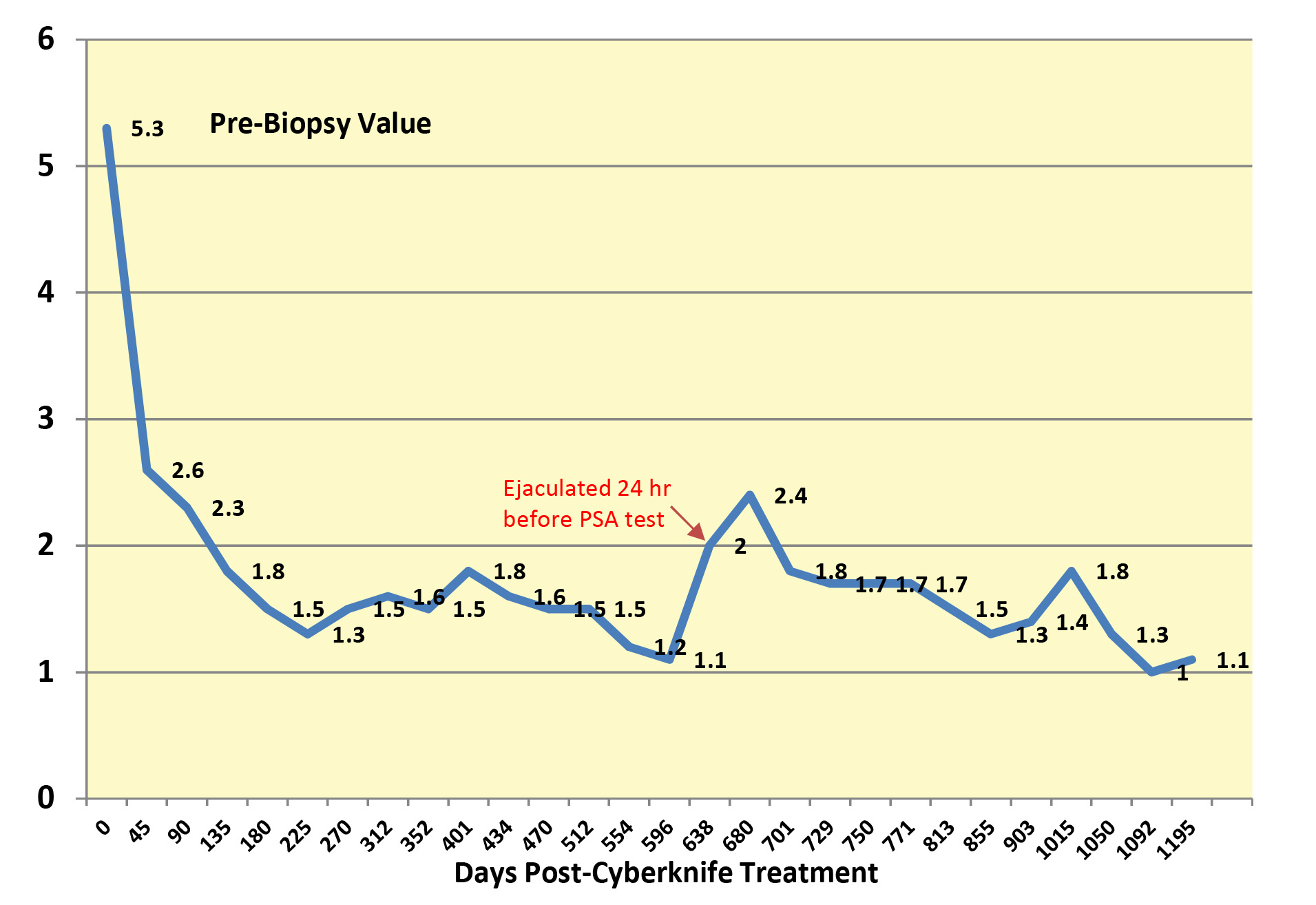 PSA Values - Post Cyberknife - 1195 Days