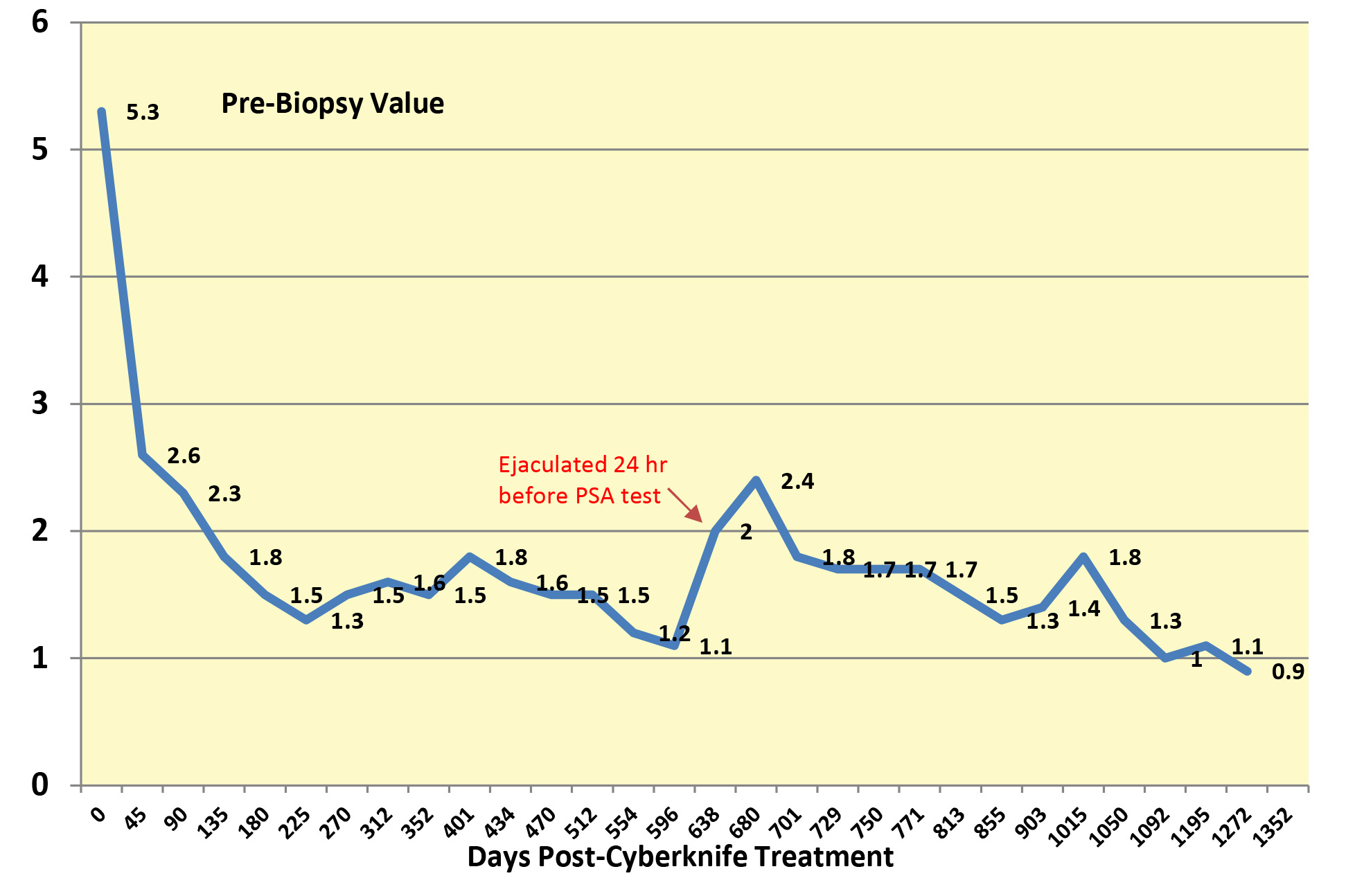 PSA Values - Post Cyberknife - 1272 Days