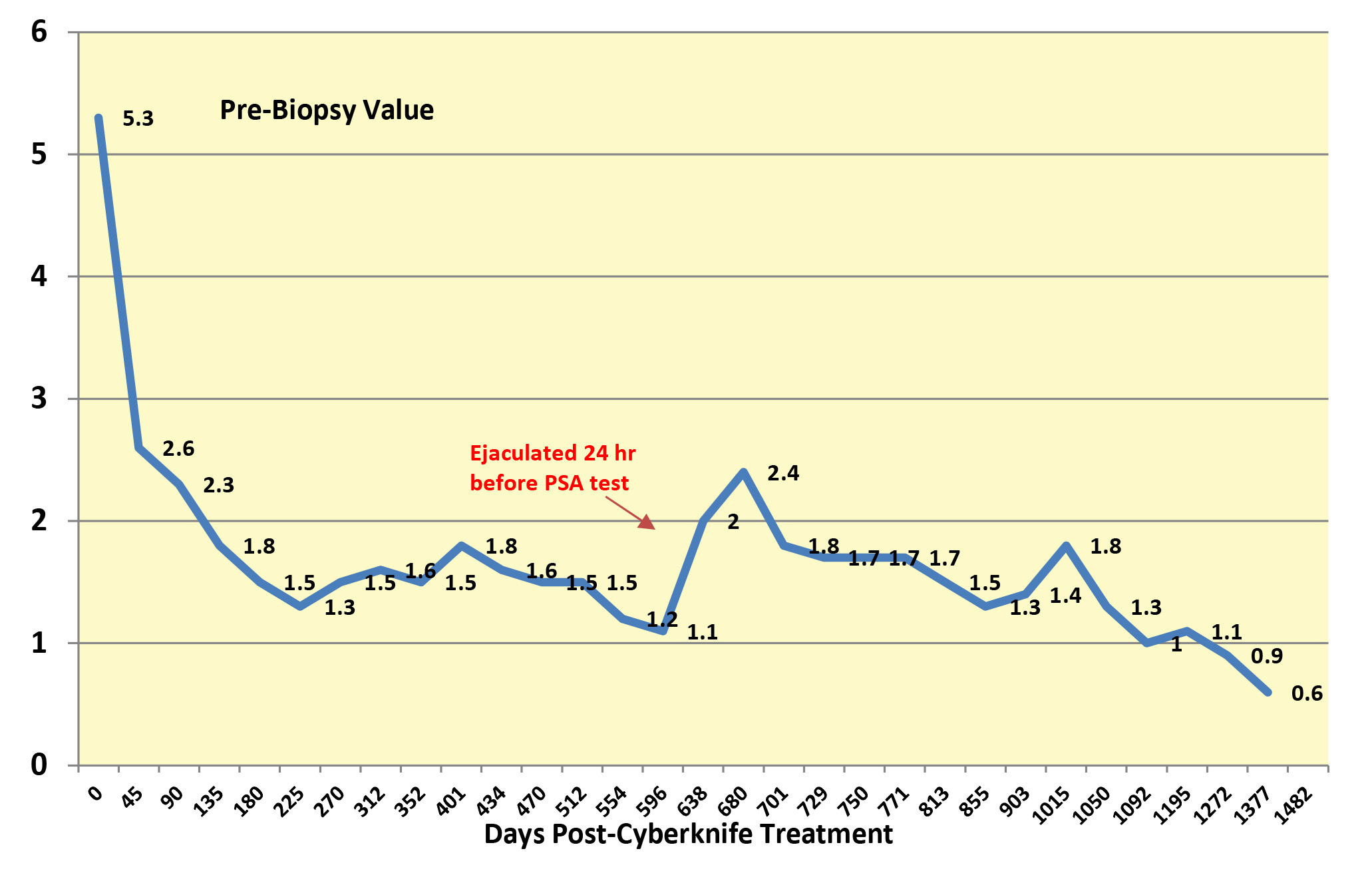PSA Values - Post-Cyberknife - 1377 Days -3-27-20_Blog