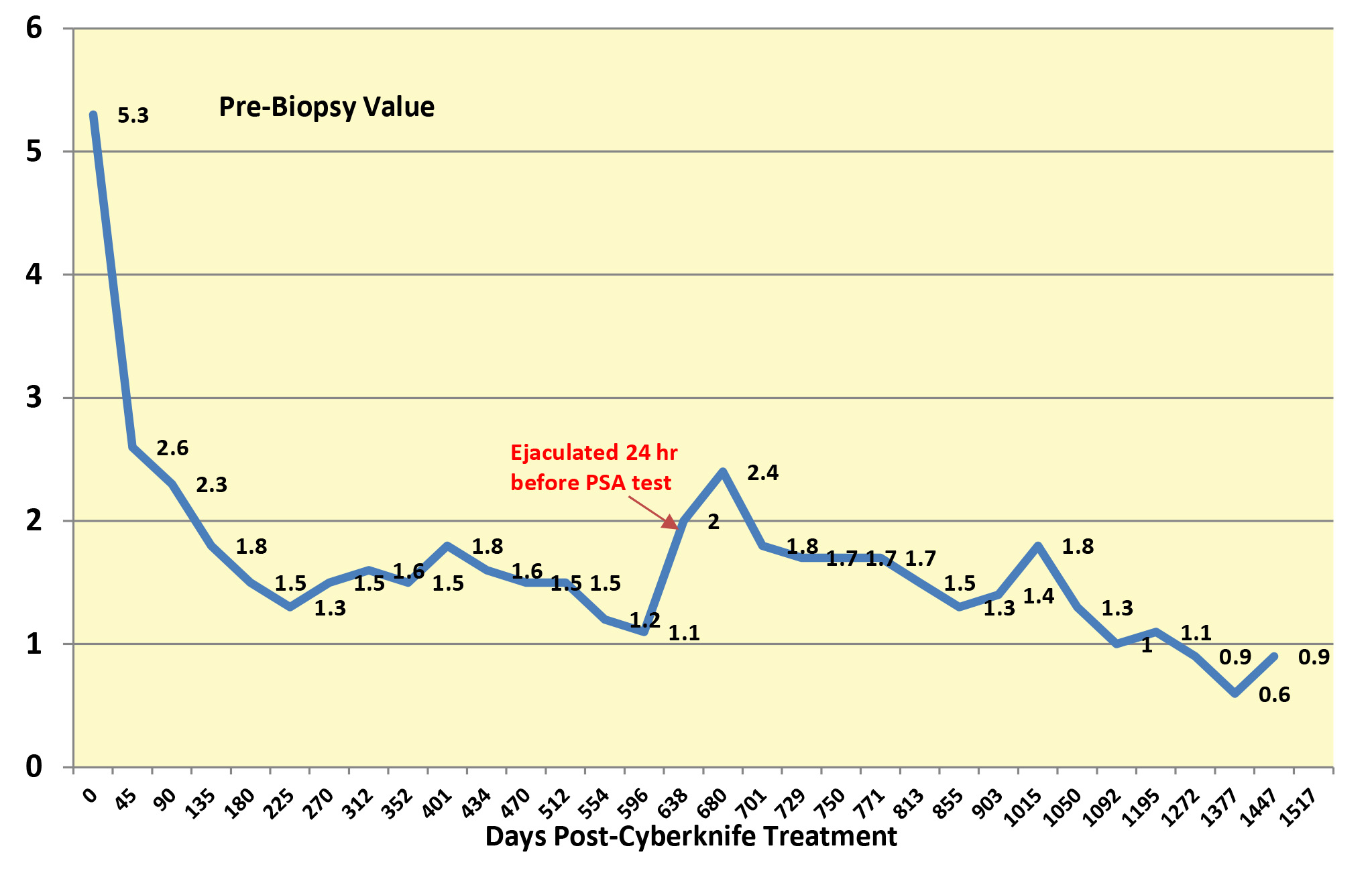 PSA Values - Post-Cyberknife - 1447 Days -6-10-20_Blog