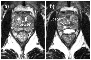SpaceOAR - Before - After